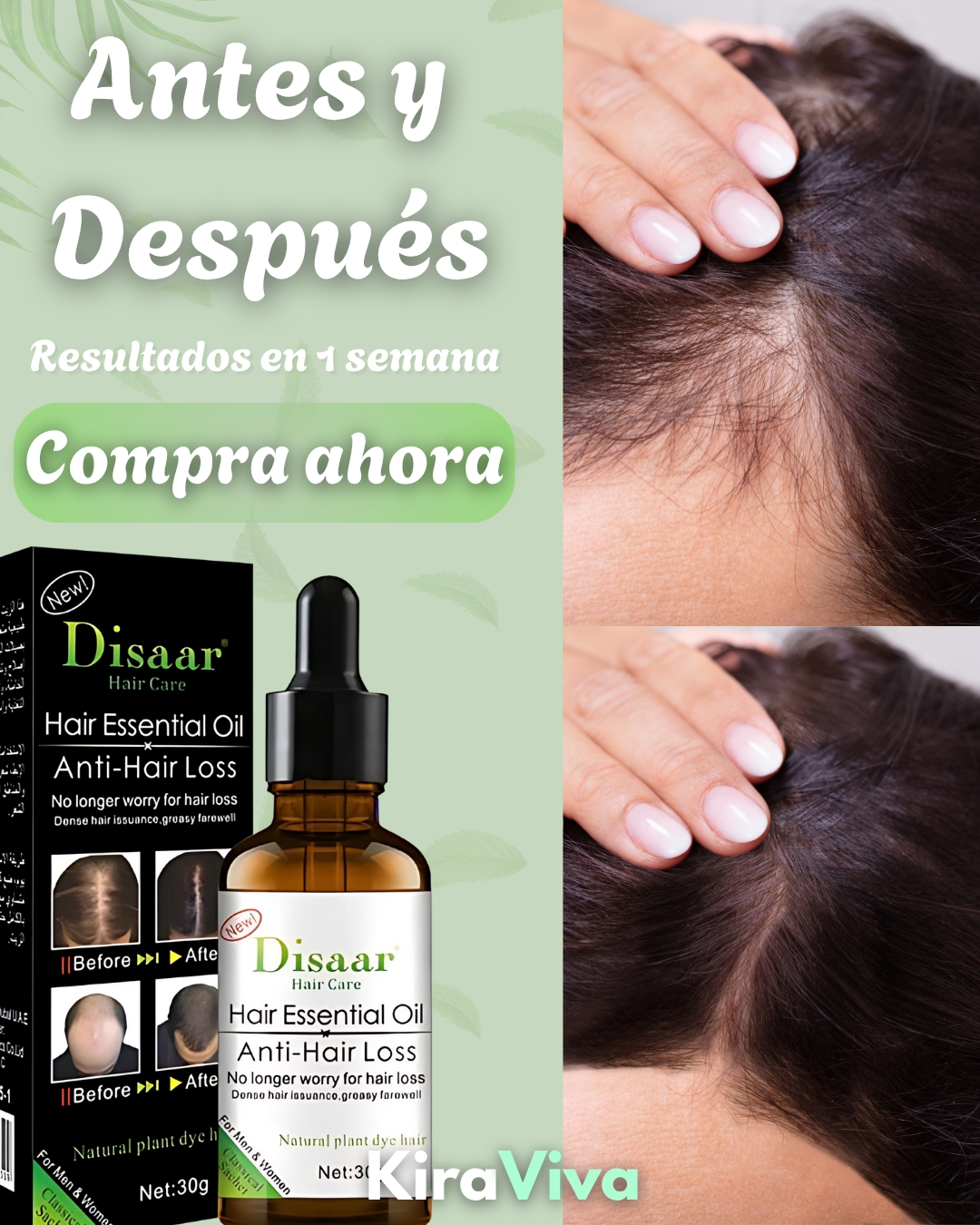 Pack Crecimiento Serum + Shampoo